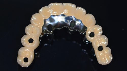 Tandtekniska-Laboratoriet-implantat-nr-3518