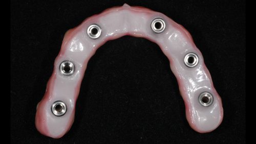 Tandtekniska-Laboratoriet-implantat-nr-8926