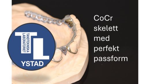 CoCr skelett med perfekt passform